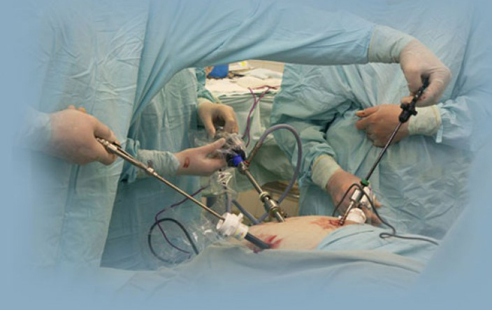 Laparoscopic-Surgery