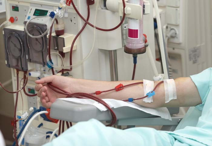 Haemodialysis