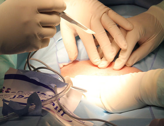 Obstetrics-&-Gynae