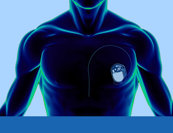 pacemaker-img